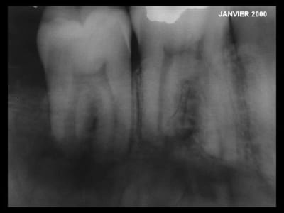 Rx3 jzecpg - Eugenol