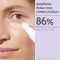 CAUDALIE - Vinoperfect Brightening Eye Cream Κρέμα Ματιών κατά των Μαύρων Κύκλων - 15ml