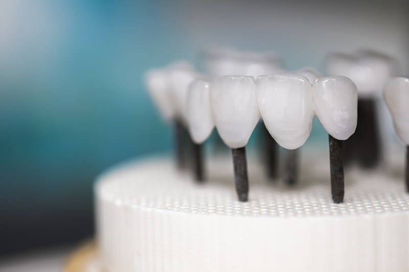 Large Dental Laboratory Adelaide Large Dental Laboratory Adelaide