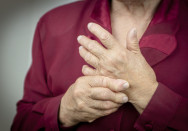 Rheumatoide arthritisymvtyf