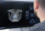 Ein Mann betrachtet ein 3D Röntgenbild des Kiefers. Blick über die Schulter.