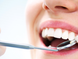 Nahaufnahme eines lächelnden Mundes während einer zahnärztlichen Untersuchung; ein Dentalspiegel wird an die Zähne gehalten, um Zahnoberflächen und Zahnfleisch zu kontrollieren.