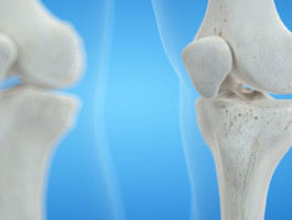 3d Illustration der Knie Knochen