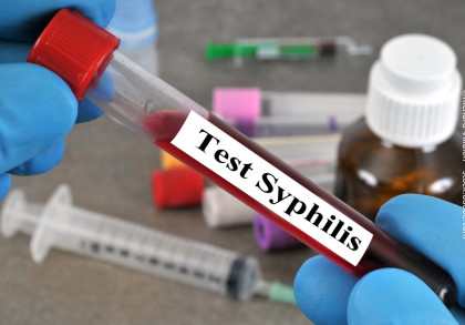Nahaufnahme eines gloved Hands, der ein Reagenzglas mit roter Flüssigkeit und einem Etikett "Test Syphilis" hält. Im Hintergrund sind unscharfe medizinische Geräte wie Spritzen und eine braune Flasche zu sehen.