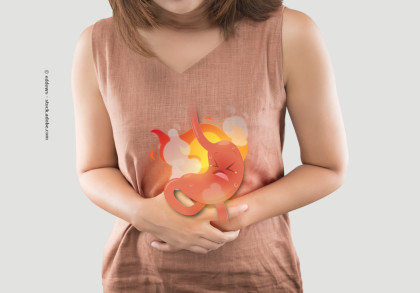 Eine Frau hält sich den Bauch vor Schmerzen. Auf dem Bauch ist eine Illustration eines wütenden und schwitzenden Magens zu sehen, umgeben von Flammen, was auf Magenschmerzen oder Sodbrennen hinweist. Die Frau trägt ein ärmelloses, beigefarbenes Oberteil.