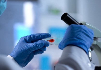 Eine Person trägt blaue Gummihandschuhe und hält ein Objektträger mit einer roten Probe unter einem Mikroskop.