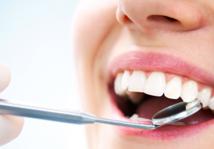 Nahaufnahme eines lächelnden Mundes während einer zahnärztlichen Untersuchung; ein Dentalspiegel wird an die Zähne gehalten, um Zahnoberflächen und Zahnfleisch zu kontrollieren.