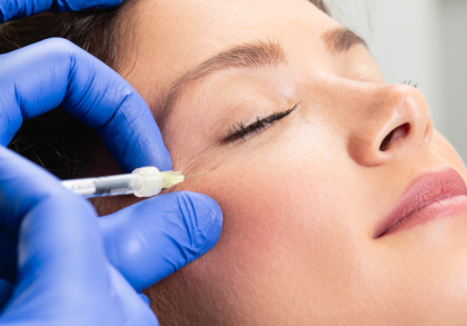 Ärztin injiziert Botulinumtoxin (Botox) mit Spritze in die seitliche Augenregion einer Patientin zur Faltenbehandlung; Nahaufnahme einer ästhetischen Behandlung mit medizinischen Handschuhen.