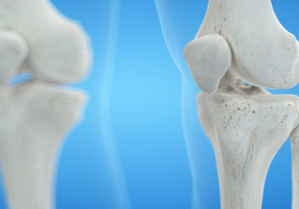 3d Illustration der Knie Knochen