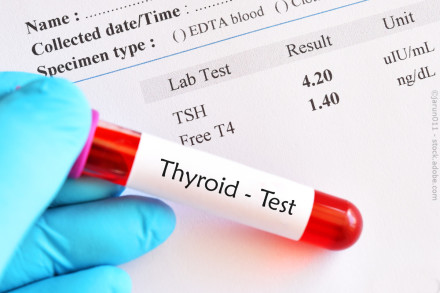 Eine Hand in einem blauen Handschuh hält einen Blutröhrchen mit der Aufschrift "Thyroid - Test". Im Hintergrund befindet sich ein Labortestergebnis, das die Messwerte für TSH (4.20 uIU/ml) und Free T4 (1.40 ng/dL) anzeigt.