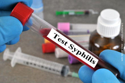 Nahaufnahme eines gloved Hands, der ein Reagenzglas mit roter Flüssigkeit und einem Etikett "Test Syphilis" hält. Im Hintergrund sind unscharfe medizinische Geräte wie Spritzen und eine braune Flasche zu sehen.