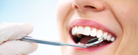 Nahaufnahme eines lächelnden Mundes während einer zahnärztlichen Untersuchung; ein Dentalspiegel wird an die Zähne gehalten, um Zahnoberflächen und Zahnfleisch zu kontrollieren.