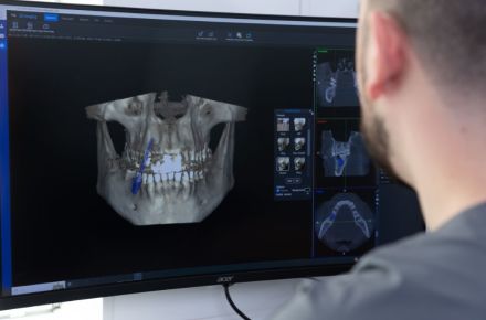 Ein Mann betrachtet ein 3D Röntgenbild des Kiefers. Blick über die Schulter.