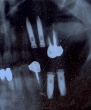 Çradios 1 i3iq0o - Eugenol