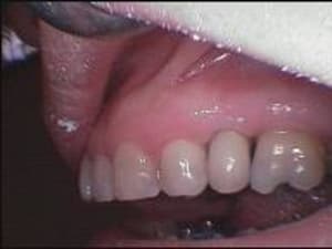 006 uuzkj7 - Eugenol