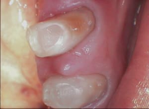 006 w44d2x - Eugenol