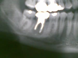 02082007 r640hw - Eugenol