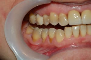 026 i51pks - Eugenol