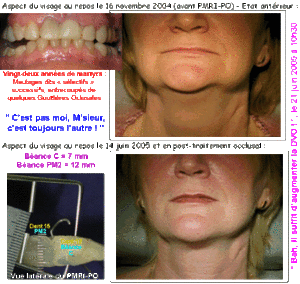 050710 22amartyrs ehhevo - Eugenol