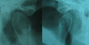 051010 atm appks8 - Eugenol