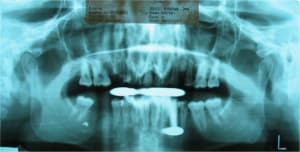 051010 pano zfzxpu - Eugenol