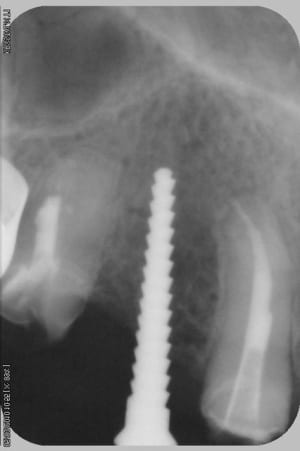 051 d0tumr - Eugenol