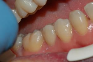 055 mlzwu3 - Eugenol