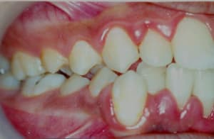 10 03 04 pd bidmzl - Eugenol