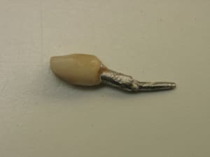 100406 001 imtfb4 - Eugenol