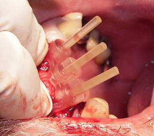 100 1396 egqwdw - Eugenol