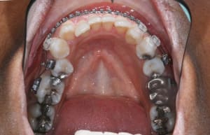 11 tqpshc - Eugenol