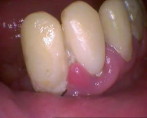 1209 zvgg21 - Eugenol
