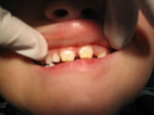 127 2741 zsn30b - Eugenol