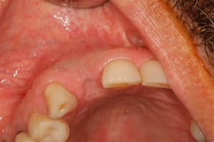 13 htemel - Eugenol