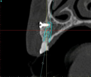 13bis qdixzh - Eugenol