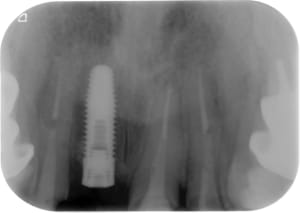 14032011 xu6iae - Eugenol