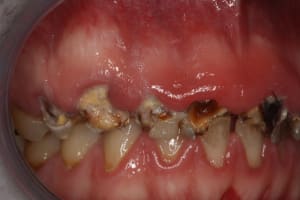 15 i9z5ip - Eugenol