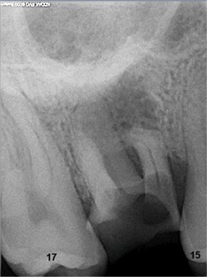 16 rx ozh60s - Eugenol