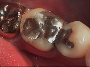 1 bmgapc - Eugenol