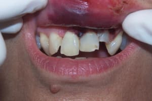 1 epw6k0 - Eugenol