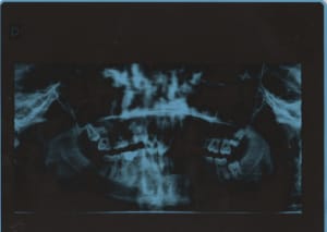 1 naxd6z - Eugenol