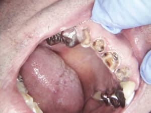 1 qpddxk - Eugenol