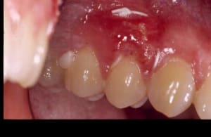 1 semaine ovm02c - Eugenol