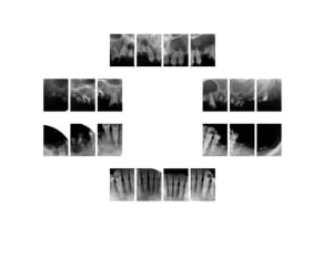 1 upoehs - Eugenol