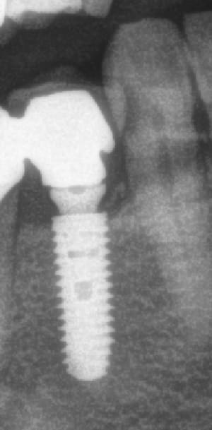 1l99tphuik3icyu63gizwxq7fjbx - Eugenol