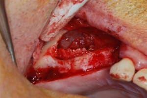 2007 10 09 008 sg7z8u - Eugenol
