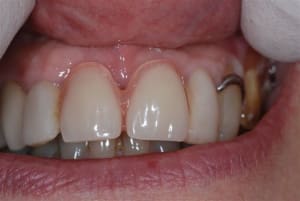 2008 01 25 009 mxrc4g - Eugenol