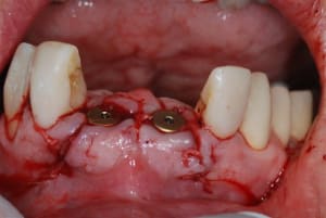 2008 01 25 015 y4tgwj - Eugenol