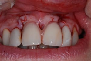 2008 01 25 018 d04q9x - Eugenol