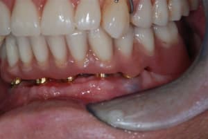 2009 07 12 003 bwm9bd - Eugenol